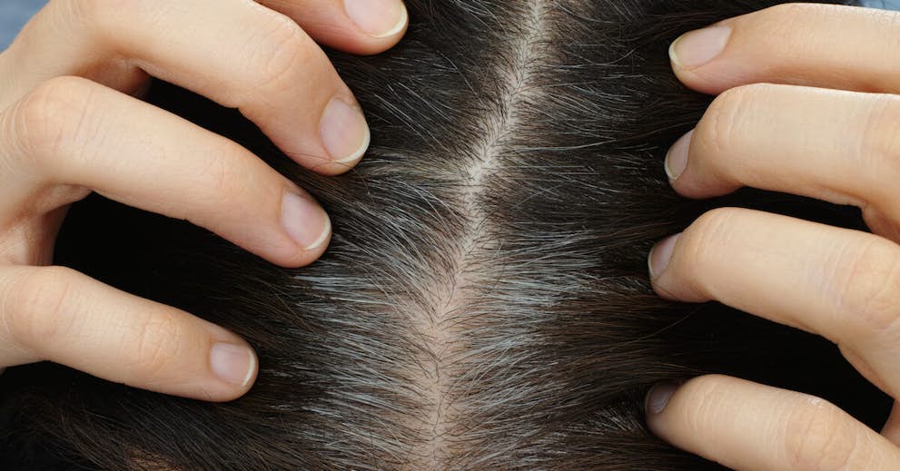 Simple Strategy that’s Clinically Proven to Reverse Graying Hair about false
