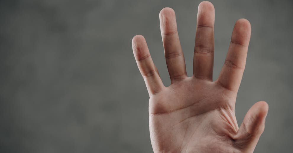 What Your Hands Can Tell You About Getting Sick With COVID Or Anything Else about false